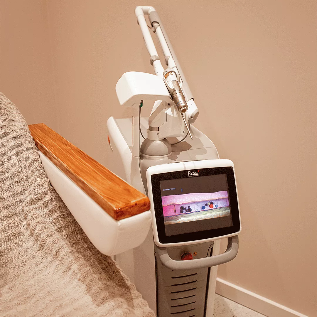 ouderdomsvlekken laseren