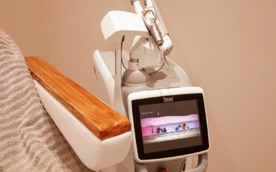 Ouderdomsvlekken laseren