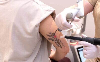 Fotona FracTAT Techniek | Nd:YAG-laser